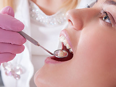 A woman receiving dental treatment with a dentist s hand holding a mirror.